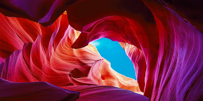OPEN HEART